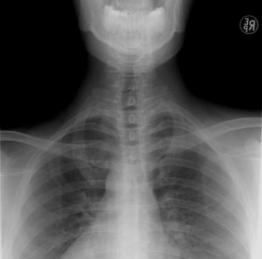 Diagnostyka obrazowa RTG